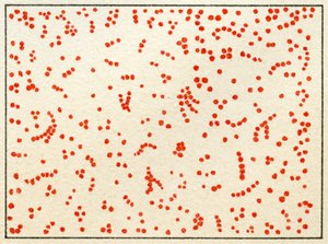 Campione di batteri Micrococcus da German School